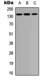 Anti-PTPD1 antibody used in Western Blot (WB). GTX56114