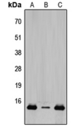 Anti-TCEAL8 antibody used in Western Blot (WB). GTX56124