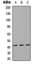 Anti-RAB8B antibody used in Western Blot (WB). GTX56137