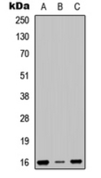 Anti-RPS23 antibody used in Western Blot (WB). GTX56138