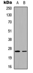 Anti-UBTD2 antibody used in Western Blot (WB). GTX56139