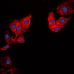 Anti-COL5A1 antibody used in Immunocytochemistry/ Immunofluorescence (ICC/IF). GTX56153