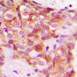 Anti-COL5A1 antibody used in IHC (Paraffin sections) (IHC-P). GTX56153