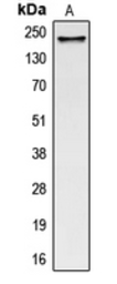 Anti-COL5A1 antibody used in Western Blot (WB). GTX56153