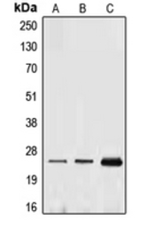Anti-Ephrin A1 antibody used in Western Blot (WB). GTX56156