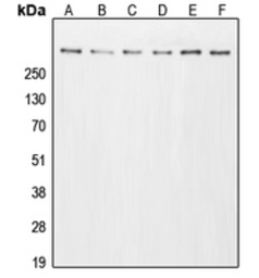 Anti-EP300 antibody used in Western Blot (WB). GTX56157