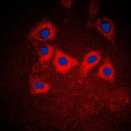 Anti-Cytokeratin 10 antibody used in Immunocytochemistry/ Immunofluorescence (ICC/IF). GTX56159