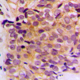 Anti-Cytokeratin 10 antibody used in IHC (Paraffin sections) (IHC-P). GTX56159