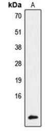 Anti-NDUFA4 antibody used in Western Blot (WB). GTX56160