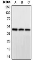 Anti-PPP1R7 antibody used in Western Blot (WB). GTX56164
