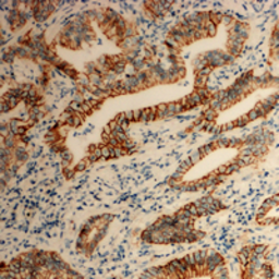 Anti-TM4SF3 / TSPAN8 antibody used in IHC (Paraffin sections) (IHC-P). GTX56175