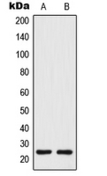 Anti-TM4SF3 / TSPAN8 antibody used in Western Blot (WB). GTX56175