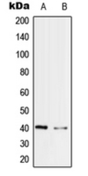 Anti-PRP18 antibody used in Western Blot (WB). GTX56179