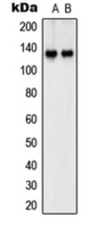 Anti-SHANK2 antibody used in Western Blot (WB). GTX56184