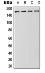 Anti-Drosha antibody used in Western Blot (WB). GTX56186