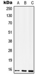 Anti-CD52 antibody used in Western Blot (WB). GTX56193