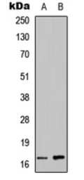 Anti-Angiogenin antibody used in Western Blot (WB). GTX56205