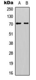 Anti-EYA1 antibody used in Western Blot (WB). GTX56207