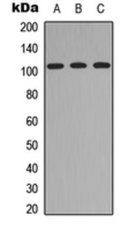 Anti-ITIH4 antibody used in Western Blot (WB). GTX56210