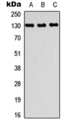 Anti-PRDM10 antibody used in Western Blot (WB). GTX56214