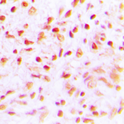 Anti-SENP6 antibody used in IHC (Paraffin sections) (IHC-P). GTX56215