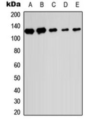 Anti-SENP6 antibody used in Western Blot (WB). GTX56215