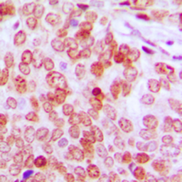 Anti-ATF5 antibody used in IHC (Paraffin sections) (IHC-P). GTX56217