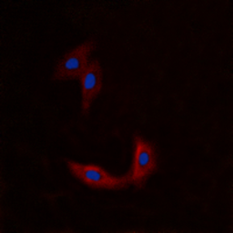 Anti-BMX antibody used in Immunocytochemistry/ Immunofluorescence (ICC/IF). GTX56219