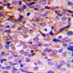 Anti-BMX antibody used in IHC (Paraffin sections) (IHC-P). GTX56219