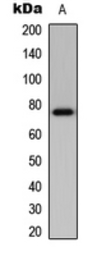 Anti-BMX antibody used in Western Blot (WB). GTX56219