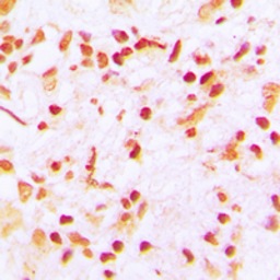 Anti-CENPA antibody used in IHC (Paraffin sections) (IHC-P). GTX56223
