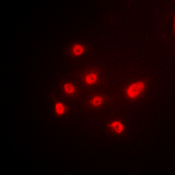 Anti-TBP antibody used in Immunocytochemistry/ Immunofluorescence (ICC/IF). GTX56239