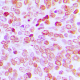 Anti-TBP antibody used in IHC (Paraffin sections) (IHC-P). GTX56239