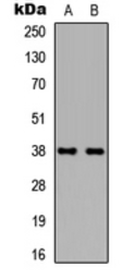 Anti-TBP antibody used in Western Blot (WB). GTX56239