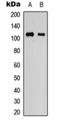 Anti-KSR1 antibody used in Western Blot (WB). GTX56241