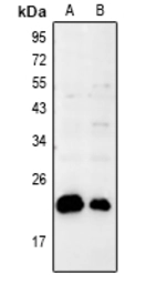 Anti-Bax antibody used in Western Blot (WB). GTX56246