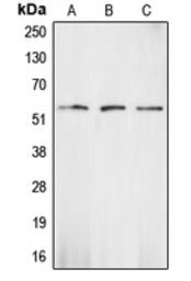 Anti-Chk1 antibody used in Western Blot (WB). GTX56248