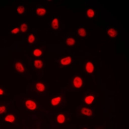 Anti-CREB antibody used in Immunocytochemistry/ Immunofluorescence (ICC/IF). GTX56252