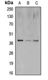 Anti-CREB antibody used in Western Blot (WB). GTX56252