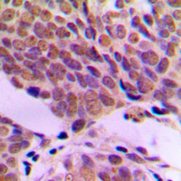 Anti-ATF2 antibody used in IHC (Paraffin sections) (IHC-P). GTX56254