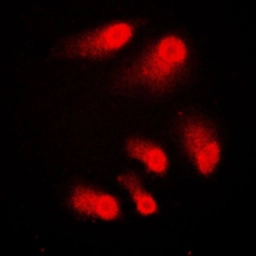 Anti-CBP antibody used in Immunocytochemistry/ Immunofluorescence (ICC/IF). GTX56255