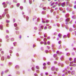 Anti-CBP antibody used in IHC (Paraffin sections) (IHC-P). GTX56255
