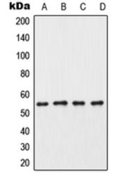 Anti-Casein Kinase I gamma 3 antibody used in Western Blot (WB). GTX56261