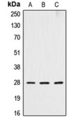Anti-Cathepsin D Heavy chain antibody used in Western Blot (WB). GTX56270