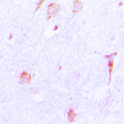 Anti-Cathepsin E antibody used in IHC (Paraffin sections) (IHC-P). GTX56272