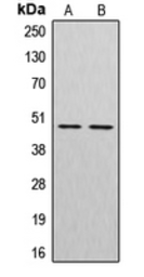 Anti-Cathepsin E antibody used in Western Blot (WB). GTX56272