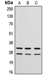 Anti-Cathepsin G antibody used in Western Blot (WB). GTX56273
