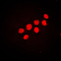 Anti-CUTL1 antibody used in Immunocytochemistry/ Immunofluorescence (ICC/IF). GTX56275