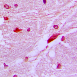 Anti-CUTL1 antibody used in IHC (Paraffin sections) (IHC-P). GTX56275