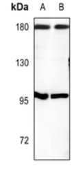 Anti-CUTL1 antibody used in Western Blot (WB). GTX56275